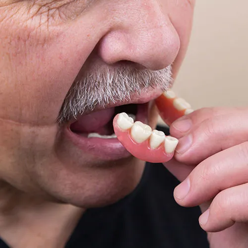 Man putting in dentures